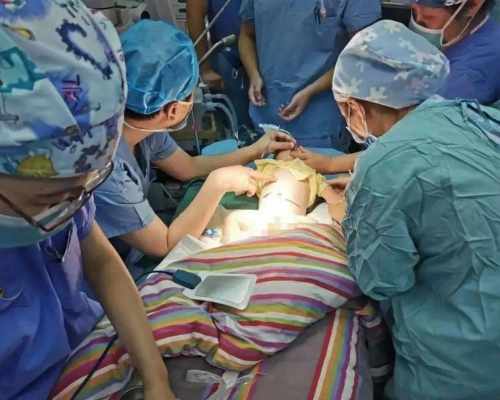 剛滿月男嬰剖腹誕下「寄生胎」。(網圖)