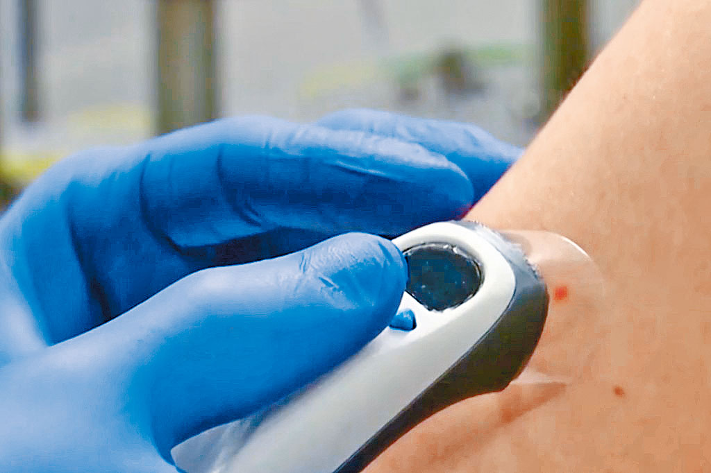 荷兰研发的无针头「泡泡枪」注射技术。