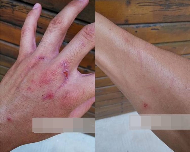 飼養員展示傷勢。