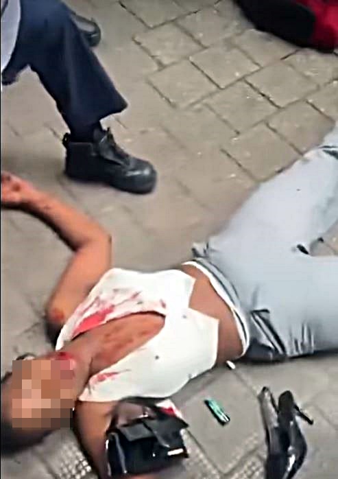 坦桑尼亞籍女子多處流血。fb:香港交通及突發事故報料區 坦桑尼亞籍女子多處流血。fb:香港交通及突發事故報料區