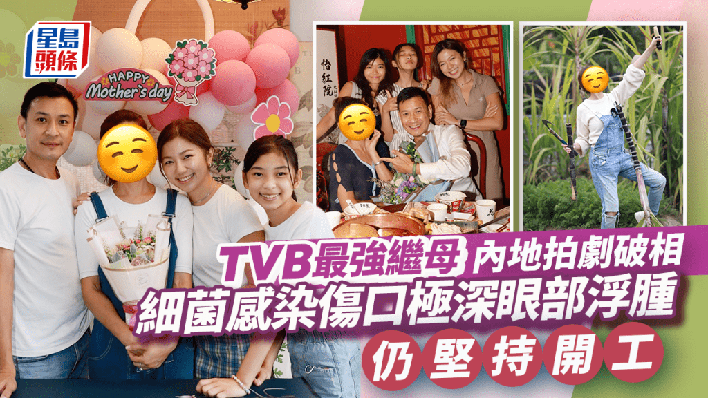 TVB最強繼母內地拍劇受細菌感染破相 傷口極深眼部浮腫 堅持開工再做直播