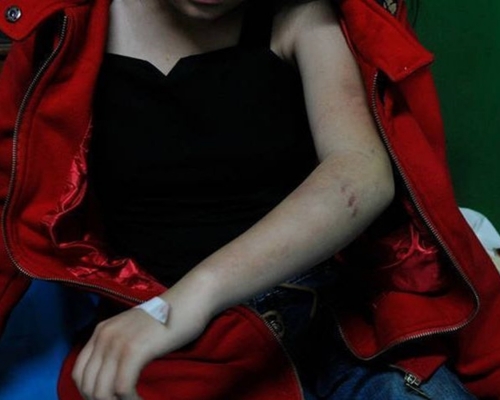 小雯事后被送院治疗。网图