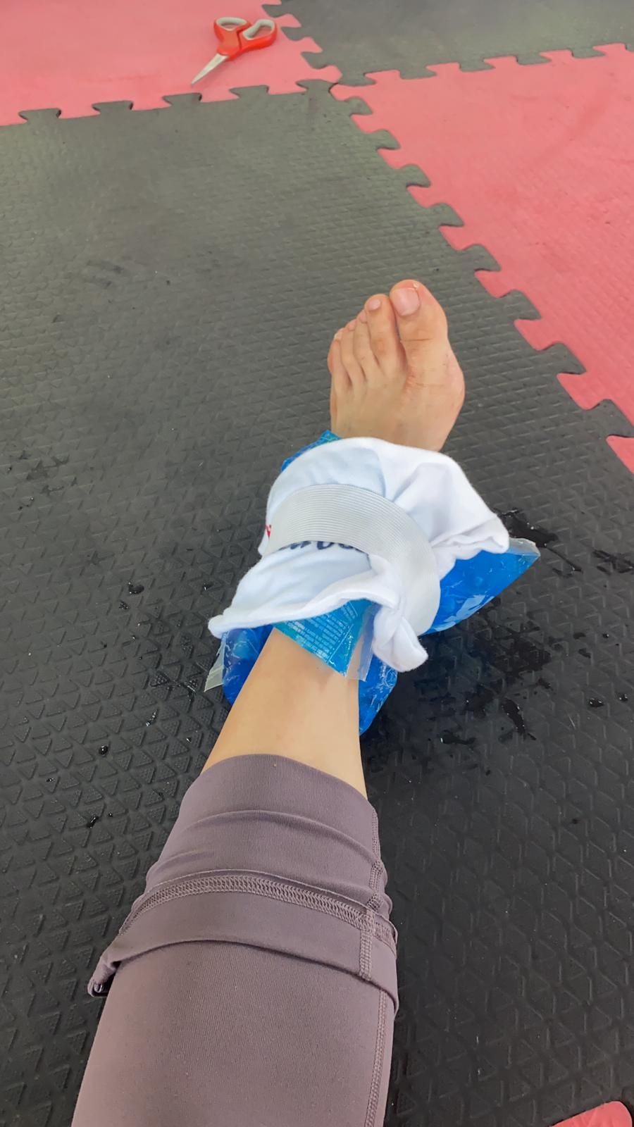 負傷開工又再「拗柴」，足踝每日要敷冰消腫。