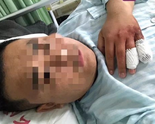 男子被斬傷。網上圖片