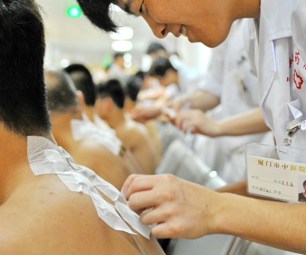 三伏贴是将辛温中药饼敷贴于背部穴位，达到「冬病夏治」的功效。新华社