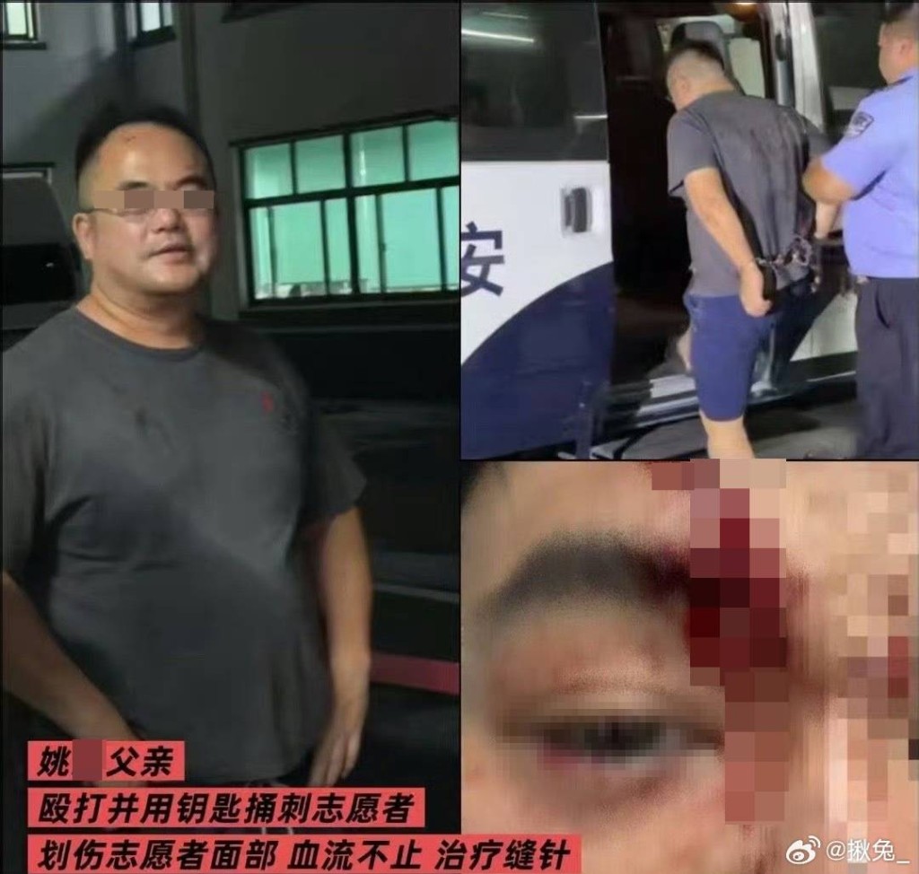 姚某的父親襲擊調查的貓義工。微博