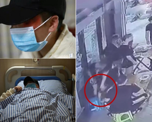 女子拒陌生男子摟抱被打成腦震盪。(網圖)