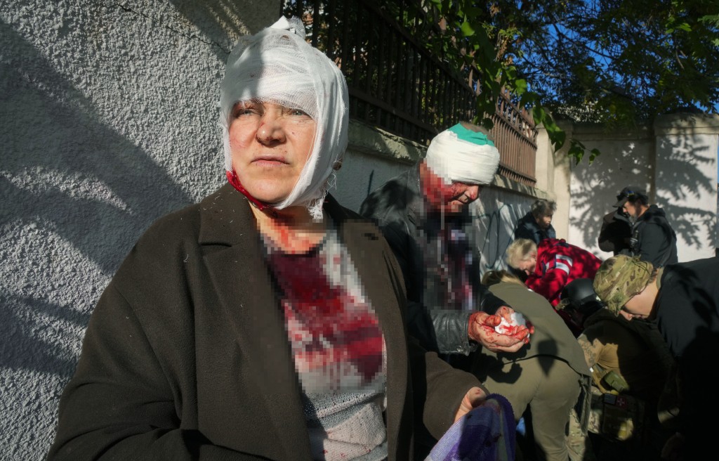 基輔民眾在俄羅斯砲擊的現場接受治療。AP