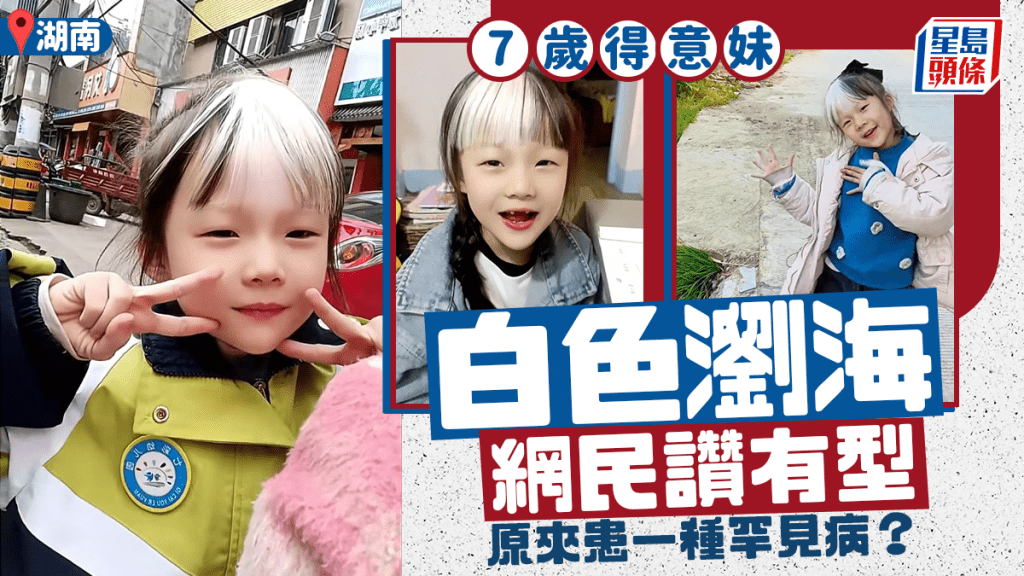 湖南7歲得意妹白色瀏海獲讚Cool  原來患一種罕見病︱有片