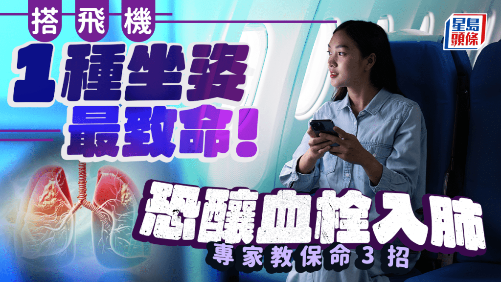 血栓|搭飛機1種坐姿最致命 恐釀血栓入肺 專家教保命3招