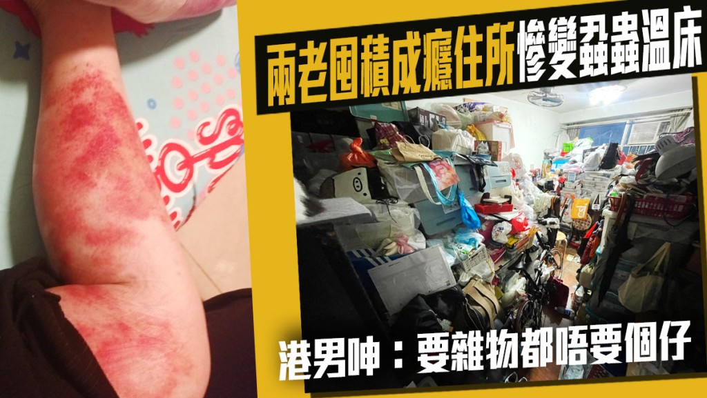 兩老囤積成癮，港男苦勸12年不果，女友被蝨蟲叮咬致皮膚病復發。FB圖片