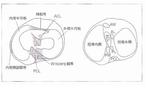 半月板受伤是运动员常见现象。 