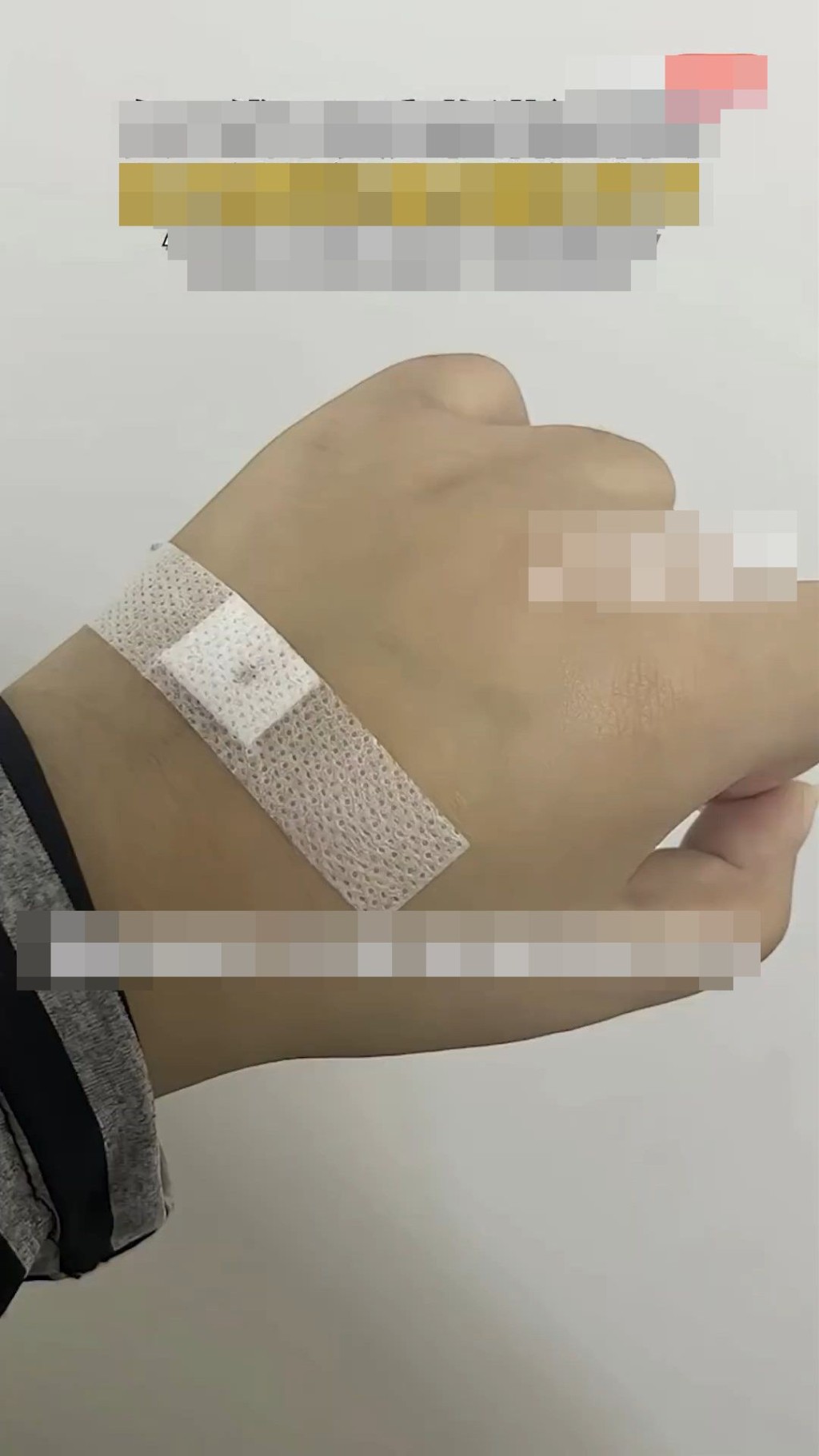 事主被感染貓癬，全身出現紅疹。微博@小莉幫忙