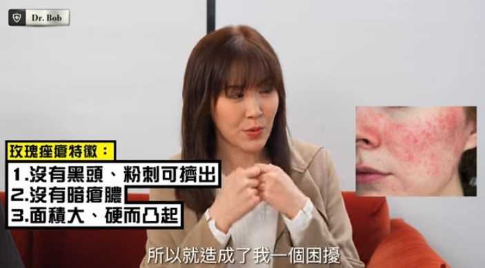 劉佩玥指患玫瑰痤瘡對她造成極大困擾。
