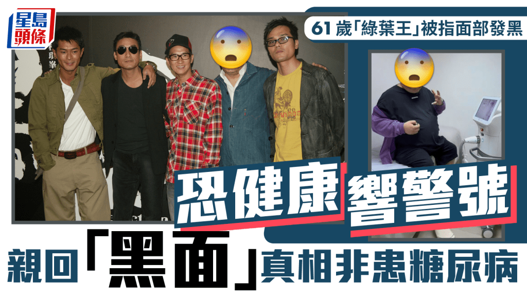 61岁「绿叶王」被指面部发黑恐健康响警号  亲自回应「黑面」真相非患糖尿病