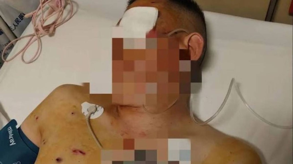 倪先生在銀行外被劫巨款兼遭打盲，批評銀行未施援阻止。紫牛新聞