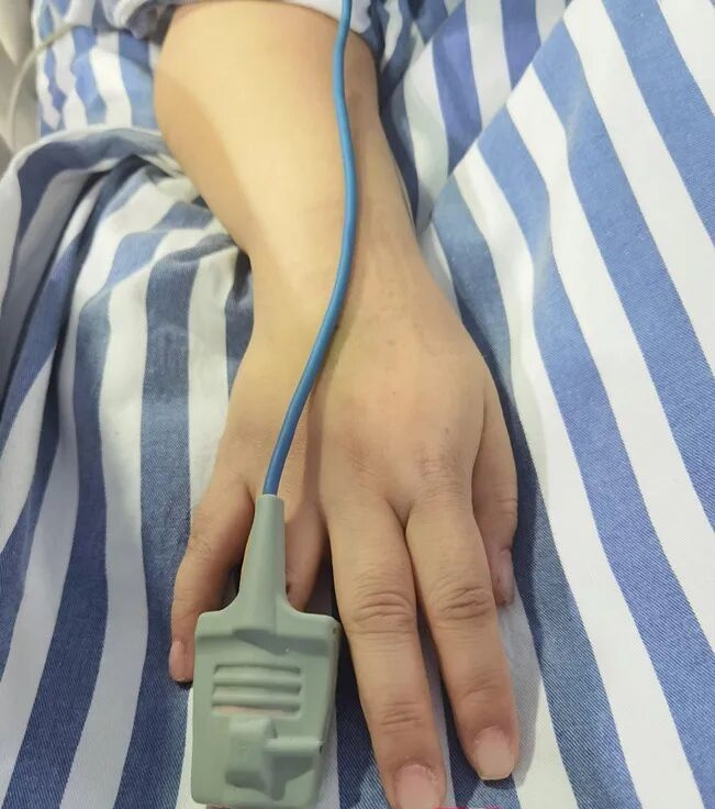 湖南女美甲太厚重，心脏病发阻碍抢救，专业美甲师到场「拆甲」。