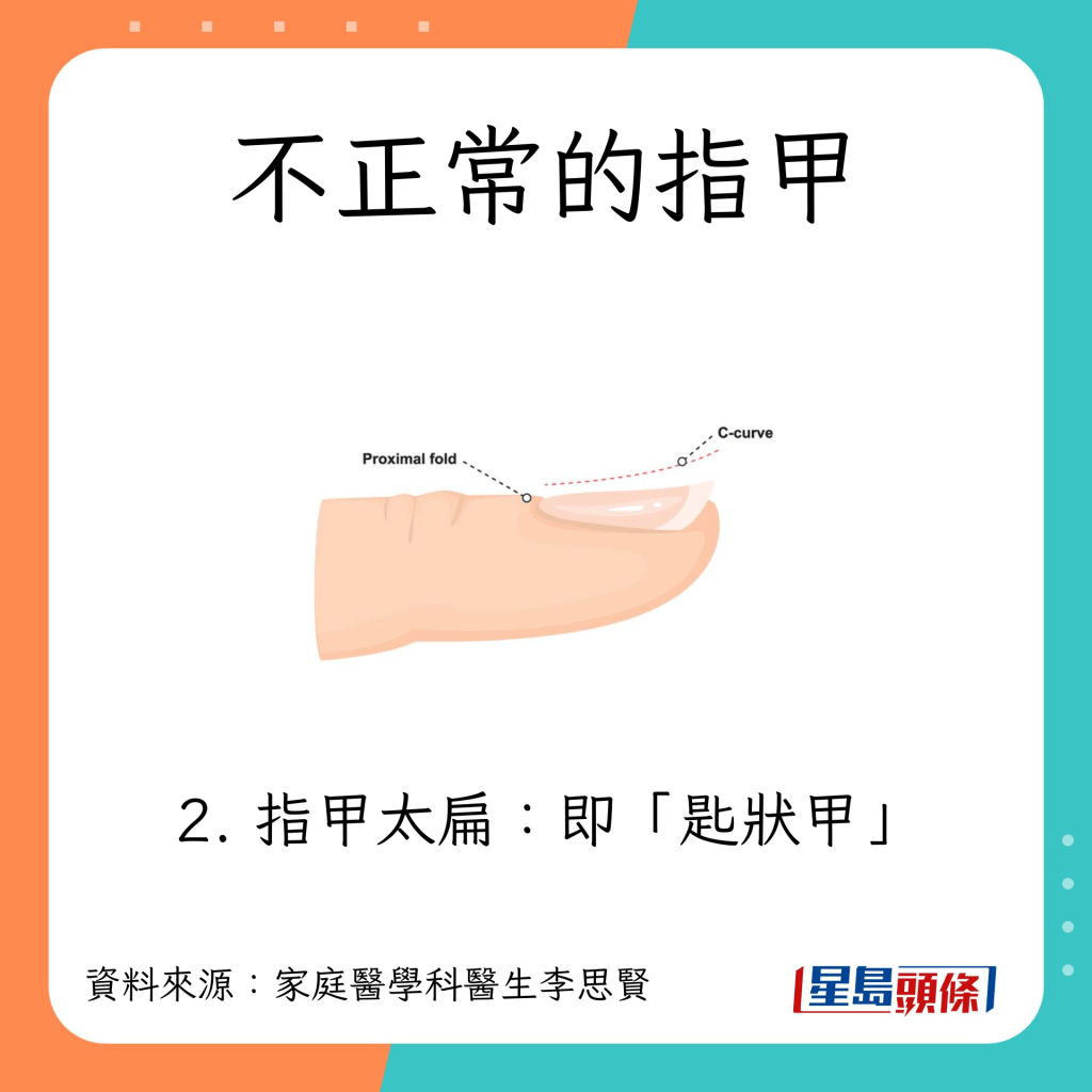 不正常指甲:匙狀甲