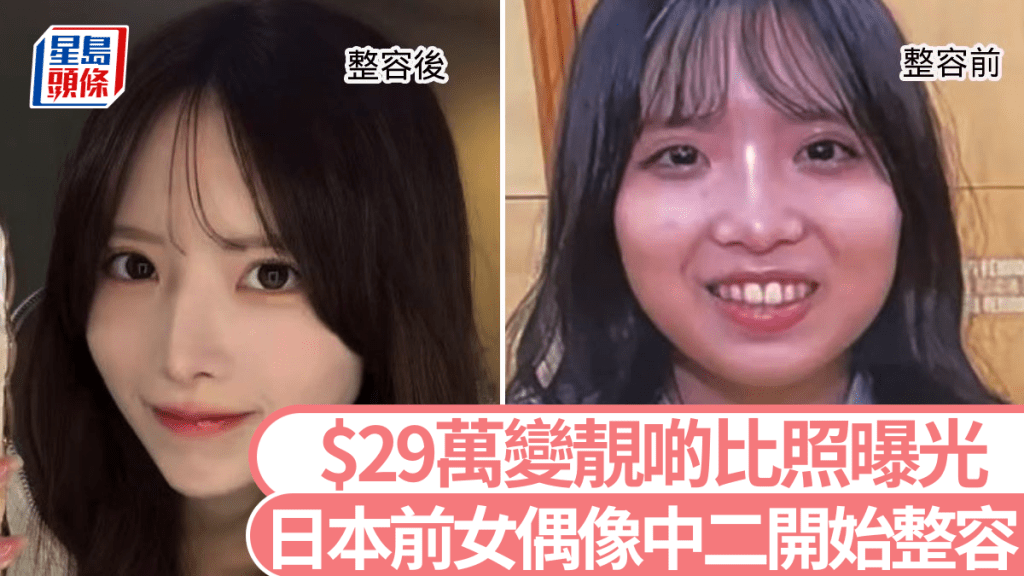 MIYU就學時以為自己「班上第三可愛」，當偶像後人氣不高變得自卑。 IG@miyu_biyo_