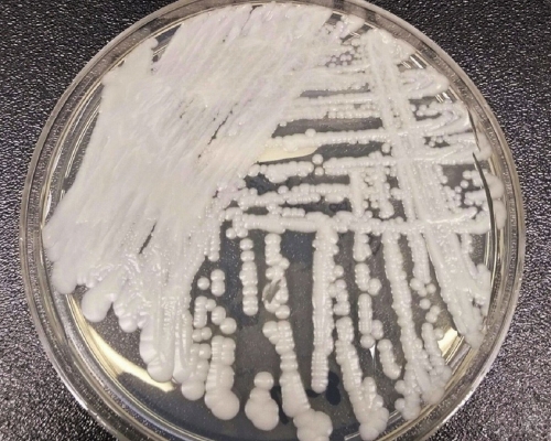 美國疾病控制與預防中心(CDC)一個實驗室在培養皿中培養出的「耳念珠菌」(Candida auris)。AP