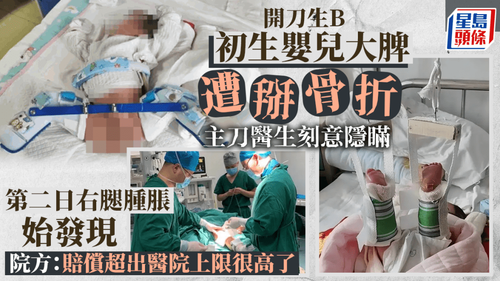 開刀生BB｜家屬稱孩子大腿被掰骨折 醫生欲隱瞞被停職