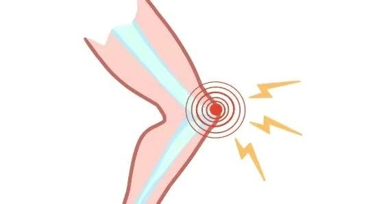 強化肌肉助減膝蓋彈響。網上圖片