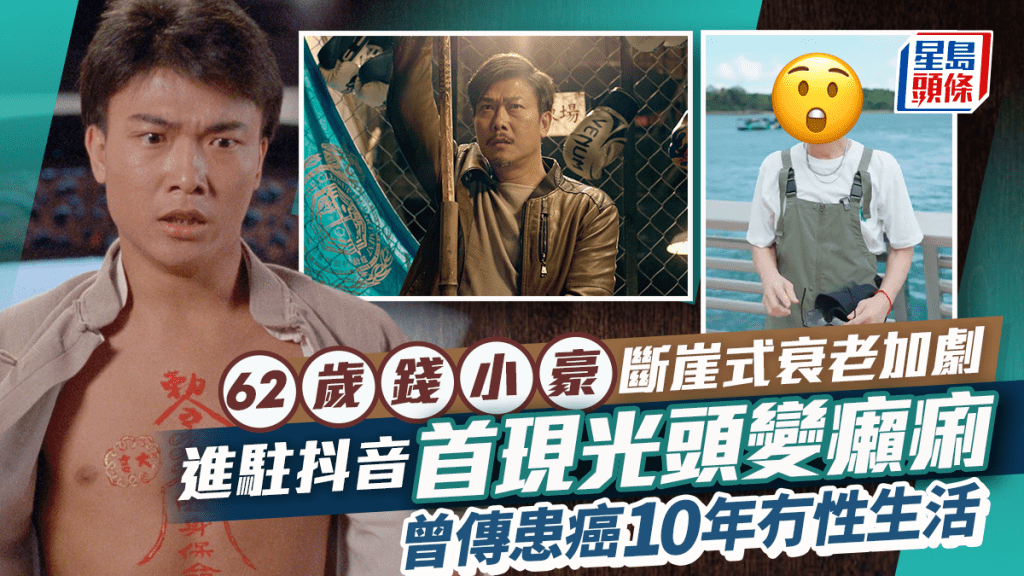 62歲錢小豪斷崖式衰老加劇   進駐抖音首現光頭變癩痢  曾傳患癌十年冇性生活