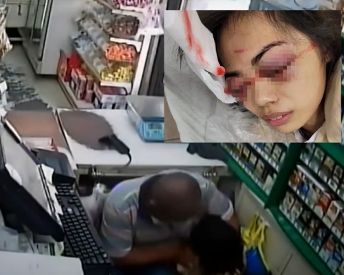 屏东女店员遭精神病汉施袭挖眼，严重受伤。 （网上图片）