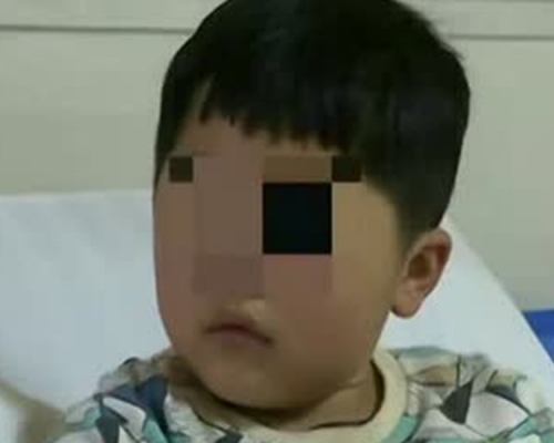 重慶六歲男童耳朵痛求醫,驚現已發芽種子。網上圖片