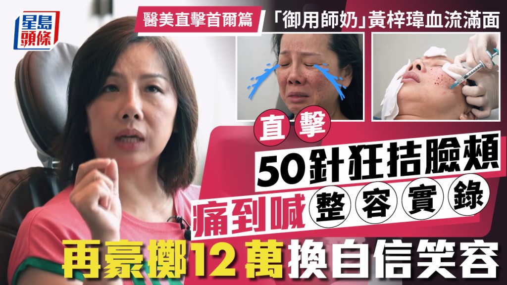 「御用师奶」黄梓玮50针狂拮脸颊血流满面  直击痛到喊整容实录  再豪掷12万换自信笑容