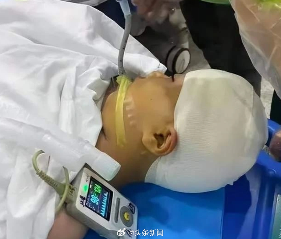 刘语辰经5小时开脑手术抢救。微博