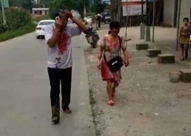 多名傷者全身染血。(網圖)