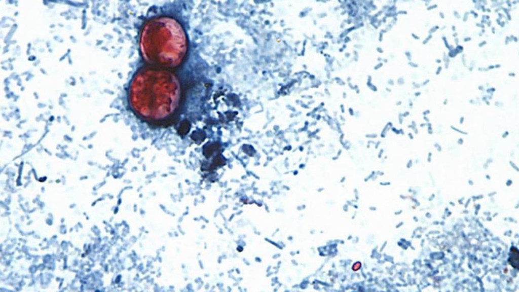 “环孢子虫”（Cyclospora cayetanensis）。 美联社资料图