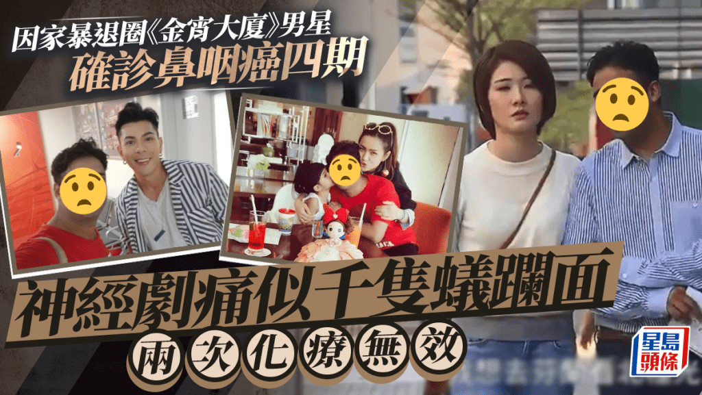 《金宵大廈》男星確診鼻咽癌   神經劇痛似千隻蟻躝面兩次化療無效 曾出軌兼家暴捱轟