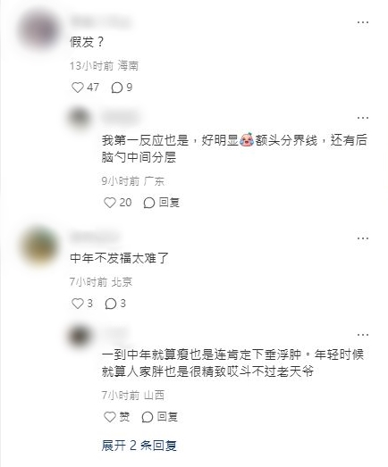 蘇有朋被質疑載假髮。