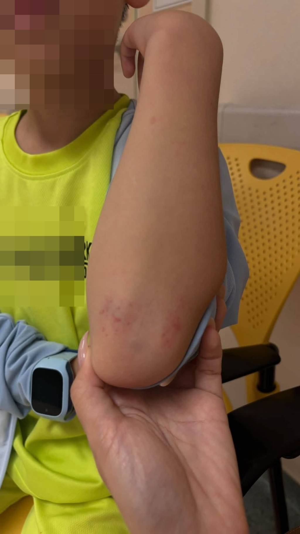 涉事男童踩著租用的單車落斜時炒車,「打筋斗」倒地擦傷手腳胸口。 涉事男童踩著租用的單車落斜時炒車,「打筋斗」倒地擦傷手腳胸口。