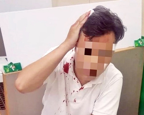 老闆頭部受傷流血,身上白色衣服沾有血跡。張秀賢facebook圖片