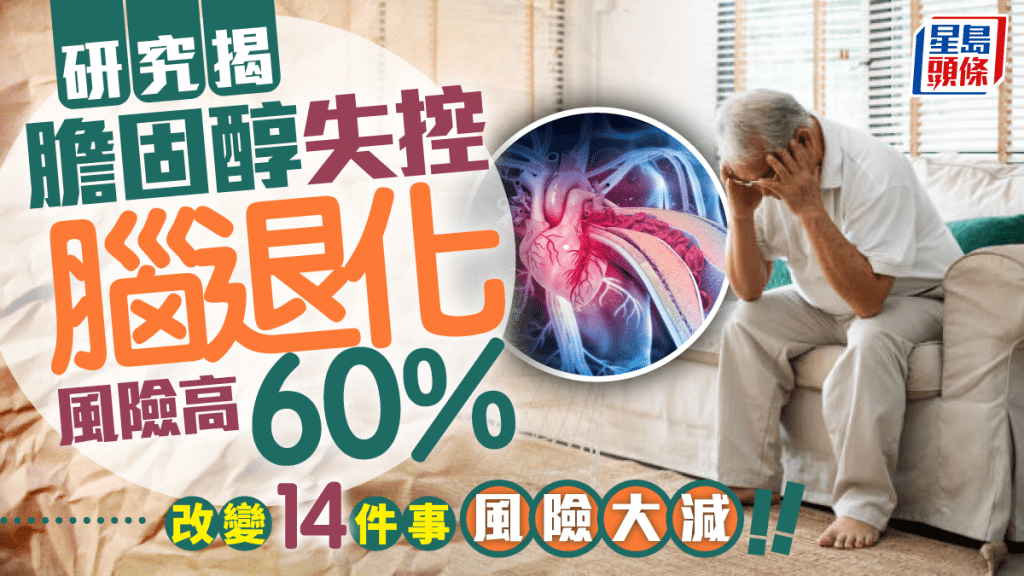 防腦退化丨研究揭膽固醇失控 腦退化風險高60% 改變14件事風險大減