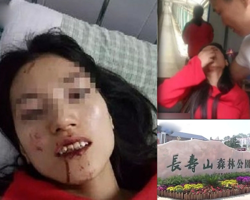 河南鞏義市的長壽山景區有女遊客受傷不輕,景區工作人員要求先重返現場拍攝取證,以便申請保險,才救人。(網圖)