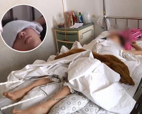 玩手遊出現幻覺,11歲少年牽妹妹4樓跳下,稱感覺不會死。(網圖)