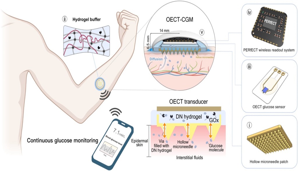 新型連續血糖監測系統名為OECT-CGM。 港大提供