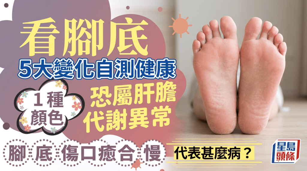 腳底傷口癒合慢代表甚麼？1種顏色恐屬肝膽代謝異常 營養師教看腳底5大變化自測健康