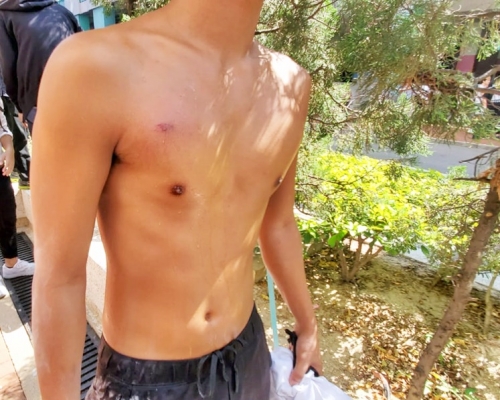 速龍小隊在廣昌閣外發射胡椒球彈時,一名男子右胸受傷。
