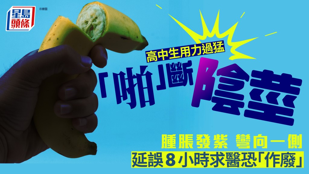 廣東高中生用力過猛「啪」斷陰莖  延誤8小時求醫可能「作廢」