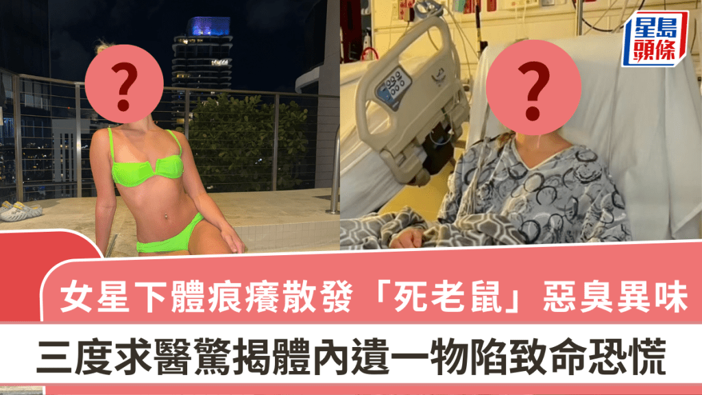 女星下體痕癢散發「死老鼠」惡臭異味    三度求醫驚揭體內遺一物陷致命恐慌