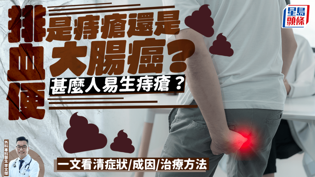 血便是因為痔瘡還是大腸癌？甚麼人易生痔瘡？一文看症狀/成因/治療方法/手術後遺症