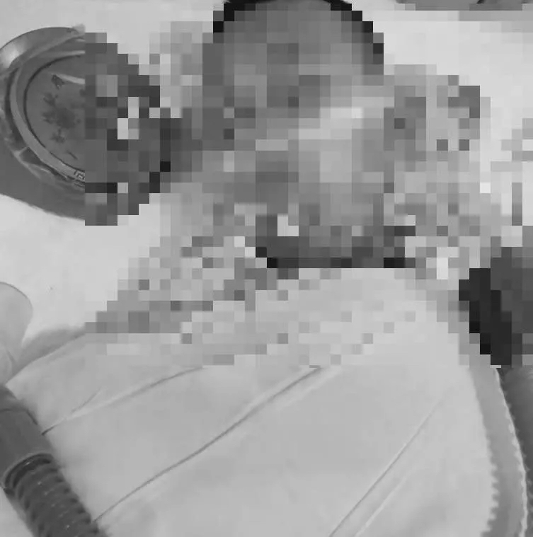 经过了11天的抢救后，8岁男童最终于8月17日下午6时多不幸逝世。 网图