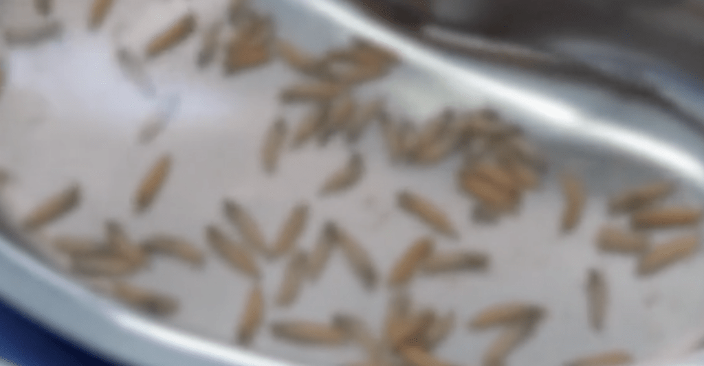 張令人吃驚的照片顯示，大量的蛆蟲在一個盛着水的鋁質皿具中漂浮着，它們全部都是從女子口中的壞死組織中取出。