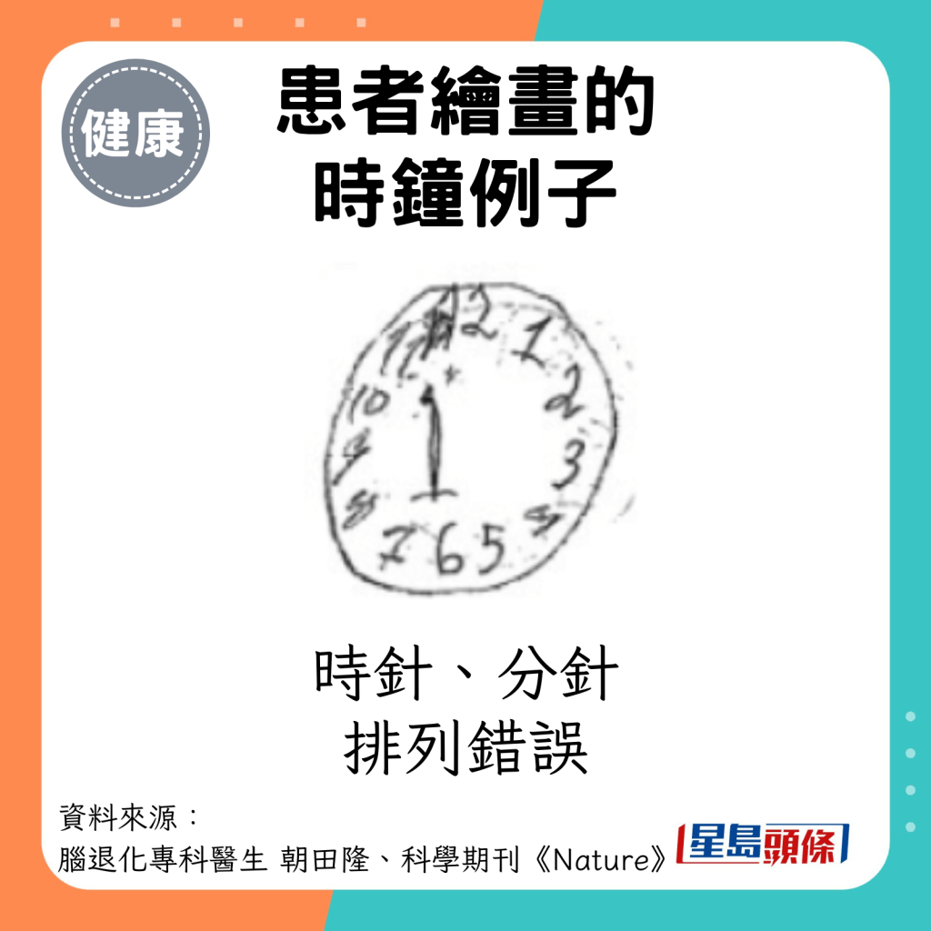 患者绘画的时钟例子：时针、分针排列错误