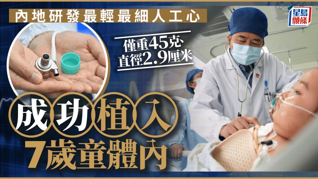 全球首例︱華研最輕最細人工心 武漢植入7歲病患